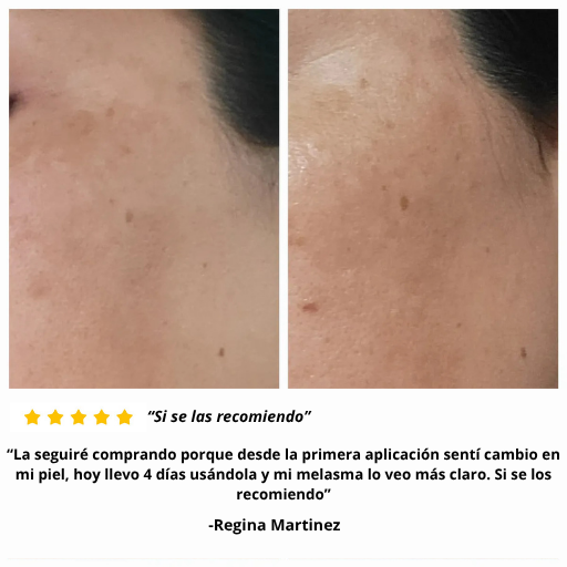 Crema Correctora de Manchas y Paño | Arbutina 7% + TXA 4%