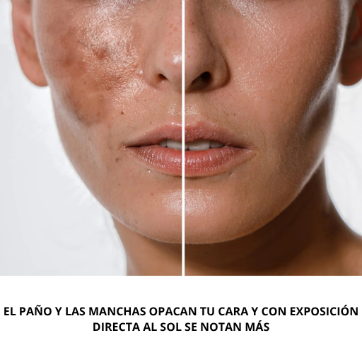 Crema Correctora de Manchas y Paño | Arbutina 7% + TXA 4%